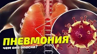 Что такое пневмония и чем она опасна / Симптомы Пневмонии
