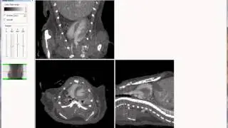 Bruker microCT training video: View cardiac gated scan in DataViewer