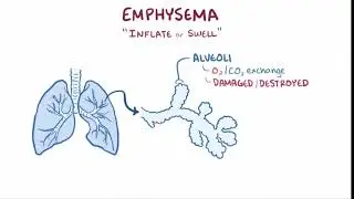 emphysema