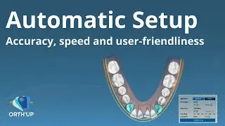 Auto Setup | ORTH'UP treatment planning for clear aligners