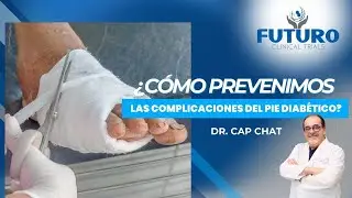 Da un paso adelante: Mejores consejos para prevenir las úlceras del pie diabético