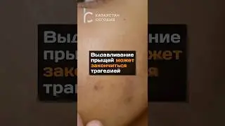 Выдавливание прыщей может закончится трагедией