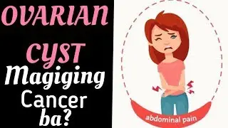 Ovarian Cyst: Symptoms and Treatment