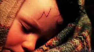 ►Harry Potter - Bones