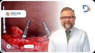 Imersão shoulders mentoria cirúrgica