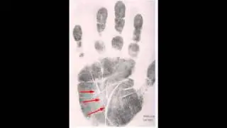 Чикатило хиромантия анализ руки.  Chikatilo palmistry