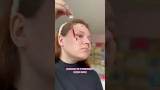 Кровавый пилинг для лица стирает пигментацию и сужает поры!? #пигментныепятна #пигментация