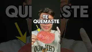 TE QUEMASTE Y TE CURO #asmr #shorts #asmrvideo #comedia
