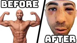Fouseytube on steroids during his boxing match? (Charity boxing match exposed part #1)