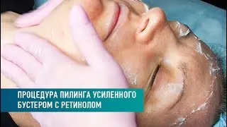 Краткий гайд по проведению процедуры пилинга усиленного бустером с ретинолом