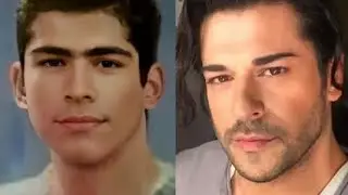 Burak Özçivitin Ergenlik Fotoğrafları!!!!
