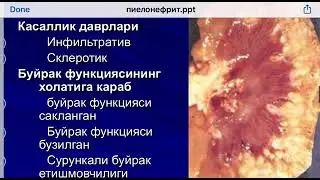 Pielonefritlar. Etiopatogenezi, davolash va profilaktikasi