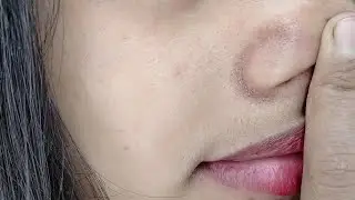 How to Remove Blackheads From Nose & Face || Naturally at Home || Priya Creations