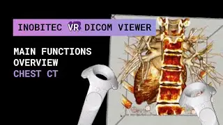 Inobitec VR DICOM Viewer functionality overview. Chest CT.