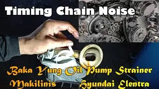 Timing Chain Noise Problem Hyundai Elentra. @jovitsfadero