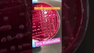 Klebsiella (клебсиелла) на питательной среде в чашке Петри. Живая слизь)