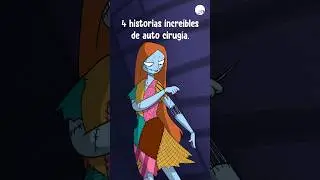 4 Historias Increíbles de Autocirugía