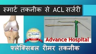 SMART Technique of ACL Reconstruction (Hindi) Best ACL Reconstruction Technique