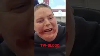 Dentist Massacre 