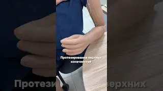 ПРОТЕЗИРОВАНИЕ В ИРКУТСКЕ #иркутск #протезирование #реабилитация #протезы #руки