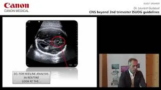 Dr. Laurent Guibaud - CNS Beyond 2nd Trimester ISUOG Guidelines