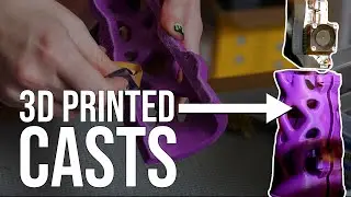 Custom Casts with 3D Printing | St. Luke's University Health Network