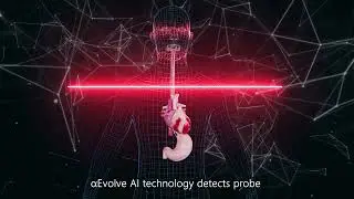 Echo Fusion for structral heart disease - 3D animation