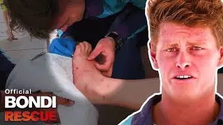 Brave Young Boy Stung By Painful Sea Urchin