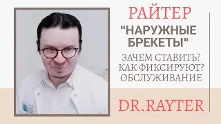 Наружные брекеты | Поставить брекеты