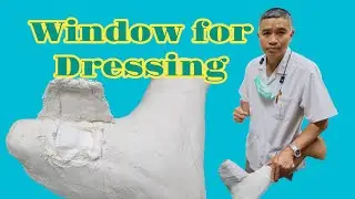 Window of Cast for Dressing