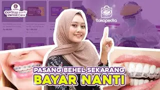 PASANG BEHEL BISA DICICIL ? Ya Hanya di Klinik Gigi Joy Dental