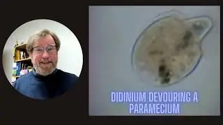 Today in Microscope Lab - Didinium
