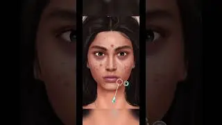 Asmr satisfying blackheads and whiteheads remove 