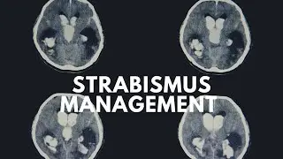 Strabismus Management (Part 2 / Arabic Language)