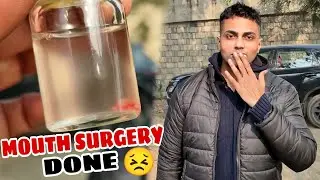 DANGEROUS MOUTH SURGERY 😱 PART 2 | RECOVERY | VIKRAM JEET S