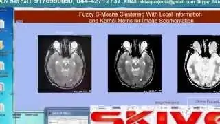 Fuzzy C-Means Clustering With Local Information and Kernel Metric for Image Segmentation