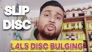 Slip disc L4 L5 disc bulging homoeopathic medicine