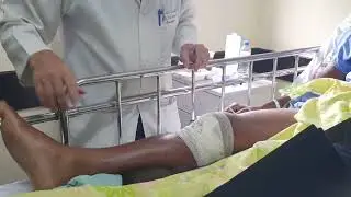 Orientação no pré operatório da fratura do fêmur @antoniovitalsampol4984