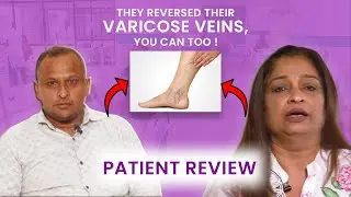 “Living with Varicose Veins: Real Stories of 3 Patients