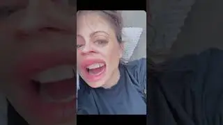 🦷 #brokentooth beats a #brokenheart