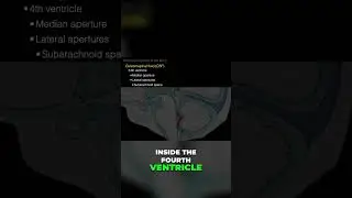 Exploring the Fourth Ventricle #shorts  #science #anatomy #doctor