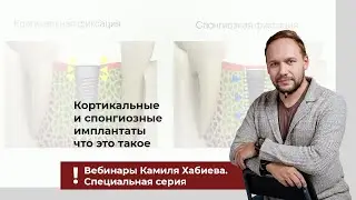 Кортикальные и спонгиозные имплантаты – что это такое?