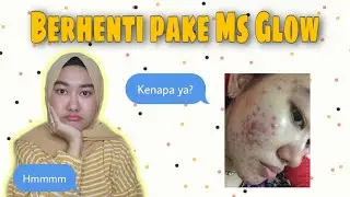 ALASAN STOP PAKE MS GLOW ACNE SERIES | REVIE MS GLOW ACNE SERIES SELAMA 2 BULAN