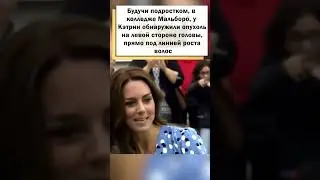 Принцесса Кэтрин перенесла операцию по удалению опухоли на голове! #shorts
