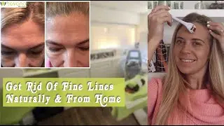 How To Derma Roller Forehead | How To Derma Roll The Face