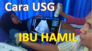 Cara Dokter Melakukan USG Ibu Hamil