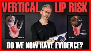 THIN LIPS RISK: Dr Tim examines surprising evidence from a cadaver study [Aesthetics Mastery Show]