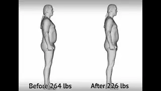 Lipo lounge fit3d scans medical weight loss