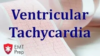 Ventricular Tachycardia ECG - EMTprep.com