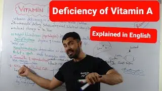 Deficiency Of  Vitamin A explained in English by Dr. Hadi